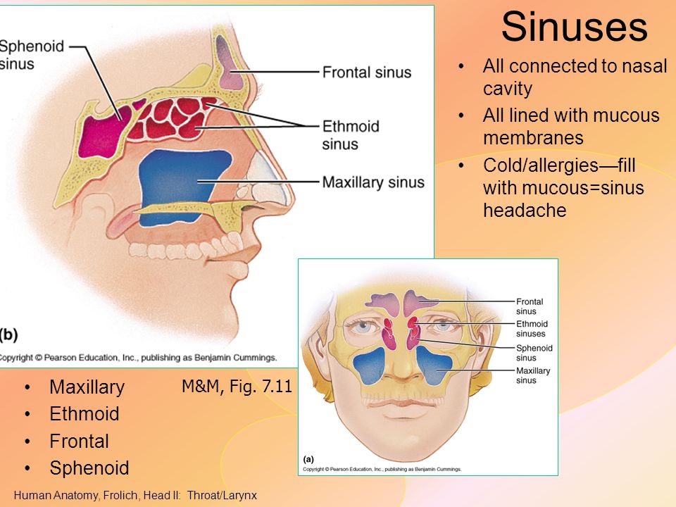 investing papilloma frontal sinus headache